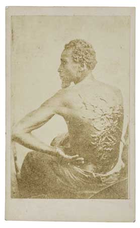 (SLAVERY AND ABOLITION--PHOTOGRAPHY.) The Scourged Back.